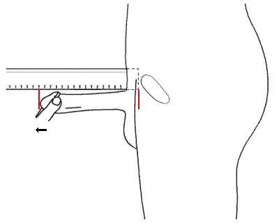Non Bone Pressed Erect Length