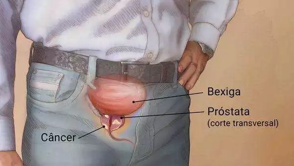 Conhecendo a próstata