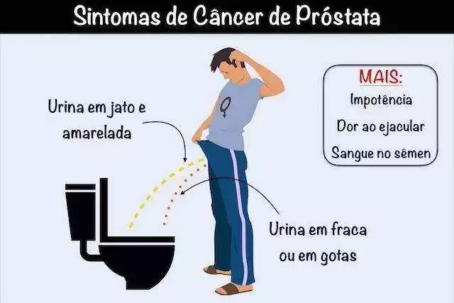 Sinais de que pode ser câncer de próstata